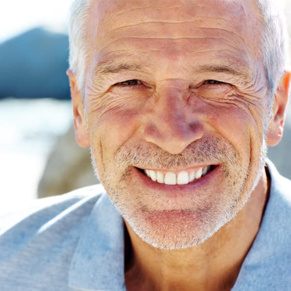 Implantes dentales